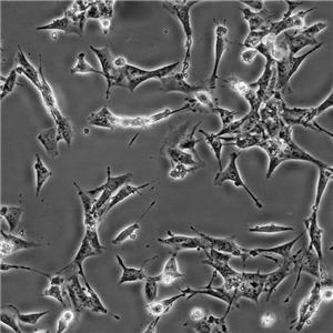 MCF7[MCF-7] Cells人乳腺癌復(fù)蘇細胞系(有STR鑒定圖譜)