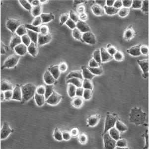 NCI-H1650 Cells人非小細胞肺癌復(fù)蘇細胞系(有STR鑒定圖譜)