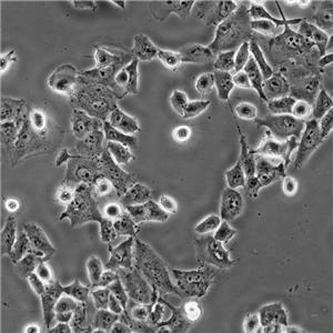 KYSE-140 Cells#人食管鱗癌細胞系源頭種子庫|培養(yǎng)基|STR圖譜