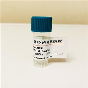 幽門螺桿菌空泡毒素抗原；幽門螺桿菌空泡細(xì)胞毒素(VacA)；幽門螺桿菌鞭毛抗原 （H）